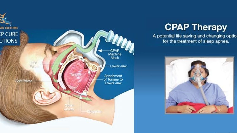 Cpap Therapy And Treatment Sleep Cure Solutions