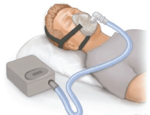 CPAP in the Covid Era